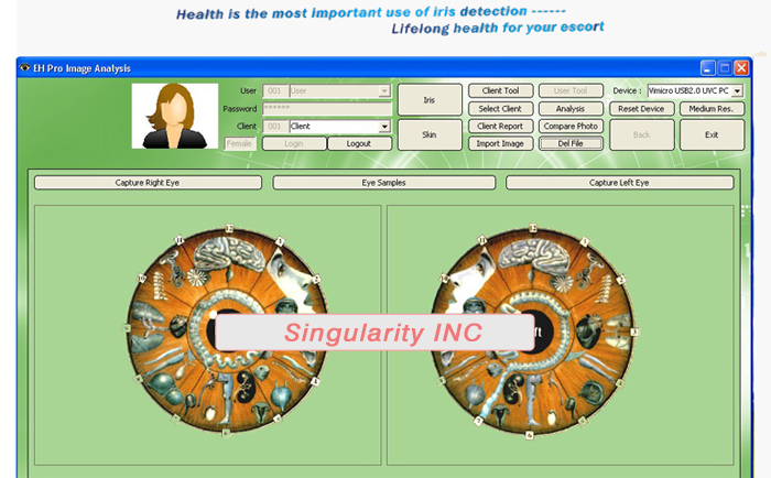 Iris Health Analyzer,5.0MP high resolution