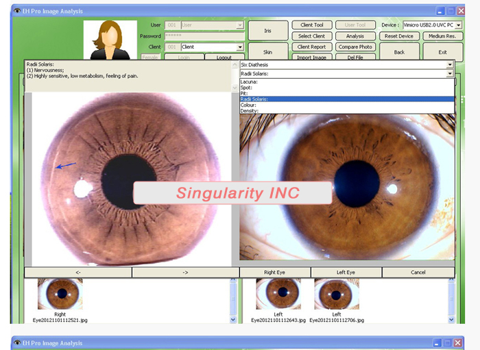 The latest Iriscope+Skin Analyzer+Hair Analyzer (3 IN1 ),5.0MP High Resolution