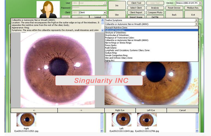 Iris Health Analyzer,5.0MP high resolution