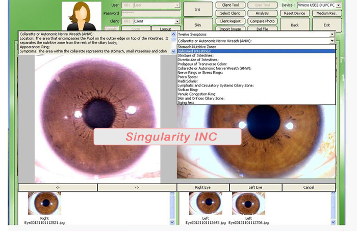 The latest Iriscope+Skin Analyzer+Hair Analyzer (3 IN1 ),5.0MP High Resolution