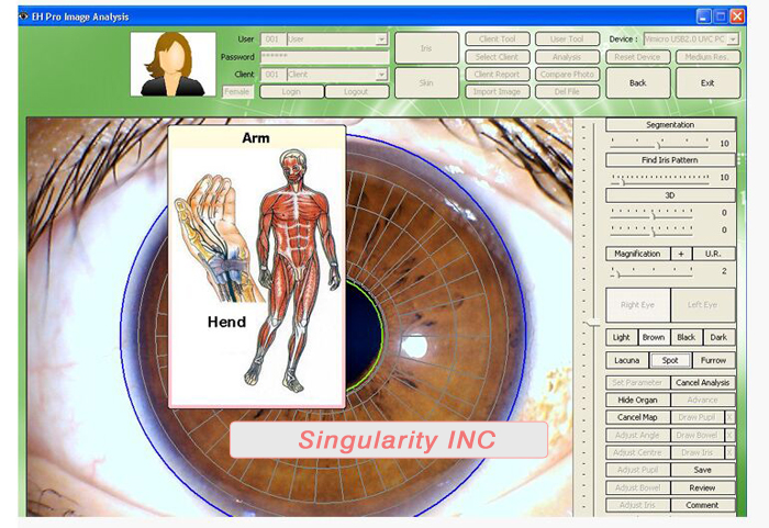 The latest Iriscope+Skin Analyzer+Hair Analyzer (3 IN1 ),5.0MP High Resolution