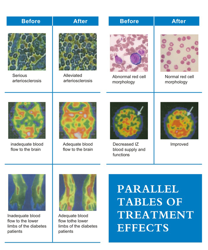 The latest semiconductor laser therapy apparatus