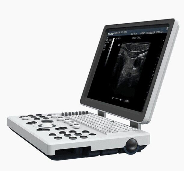 The Latest Digital Ultrasonic Diagnostic Imaging System