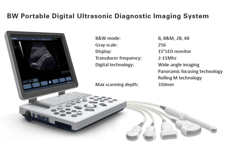 The Latest Digital Ultrasonic Diagnostic Imaging System