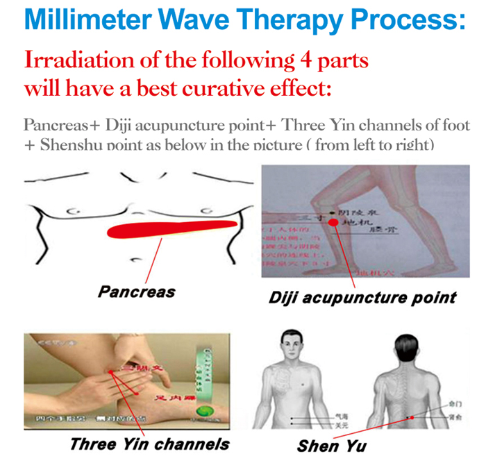 The Latest Millimeter Wave Therapy Instrument - Cancer And Diabetes Healing