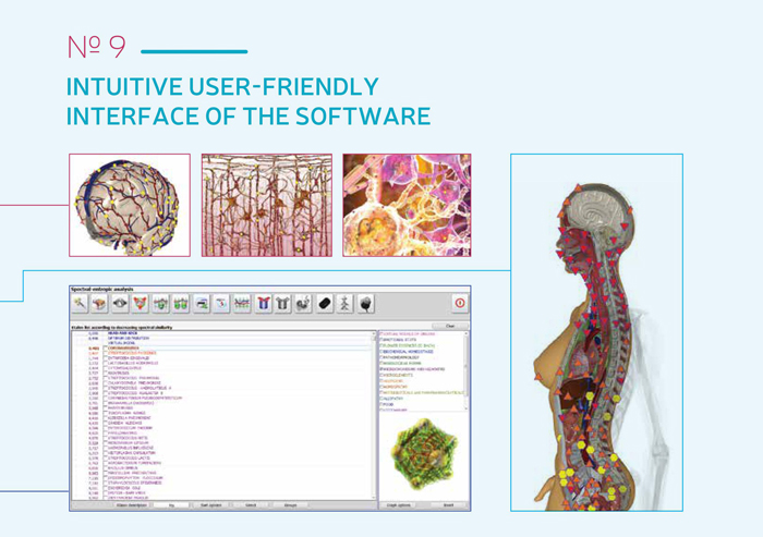 The Latest Metatron 4025 Clinical Bioresonance Machine