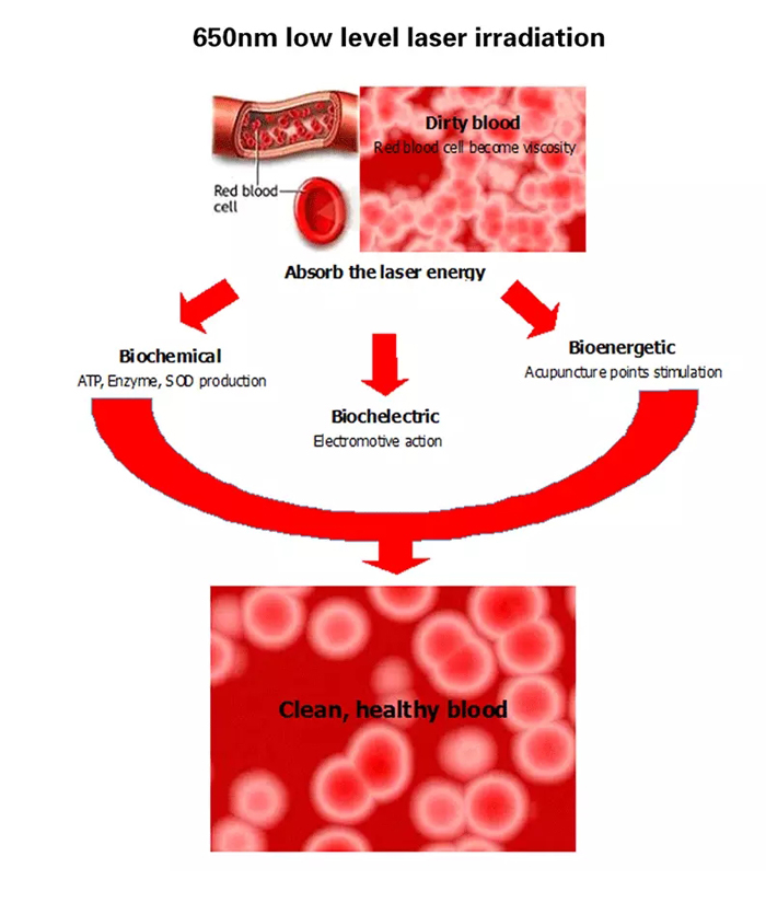 The low level laser therapeutic apparatus