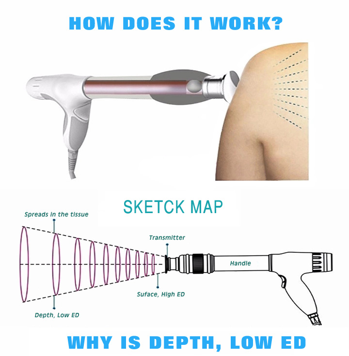 The New Shock Wave Tharapy Machine