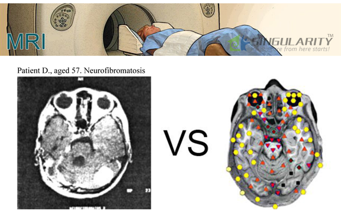 HOT!!! The 9D-NLS Bioresonance Machine