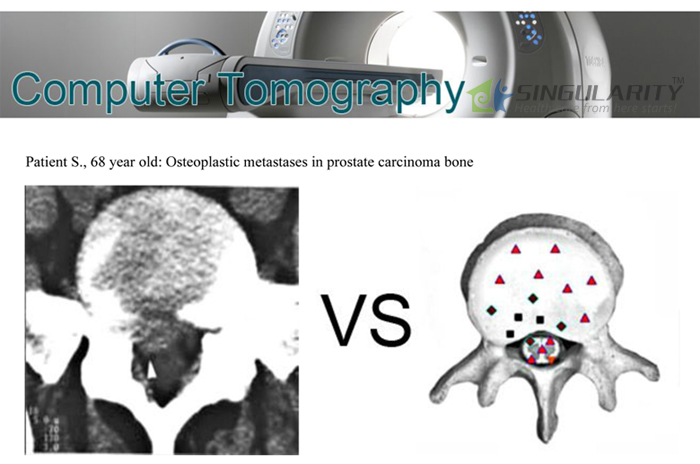 HOT!!! The 9D-NLS Bioresonance Machine