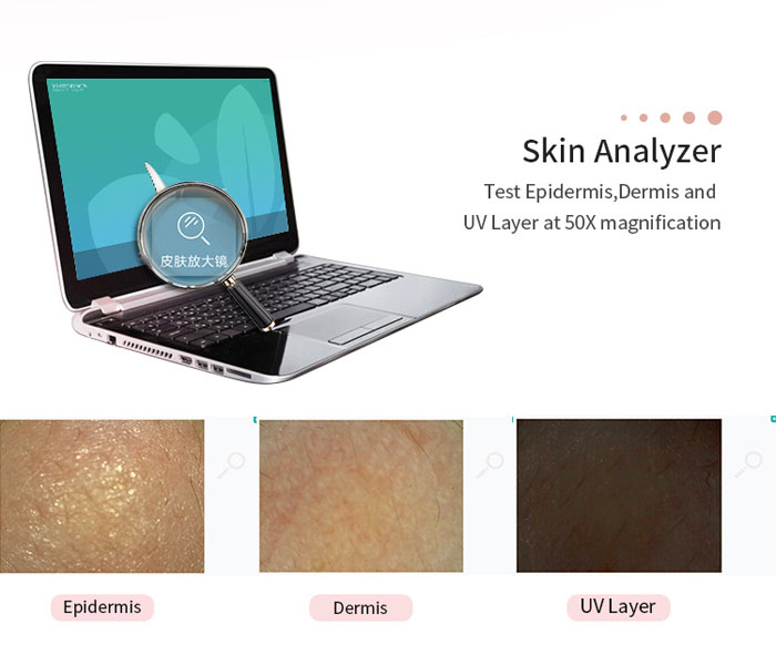 The Portable Skin Analyzer System