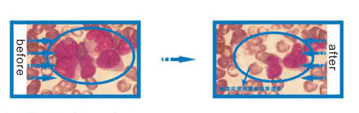 Multi-Functional Semiconductor Laser Therapy Instrument