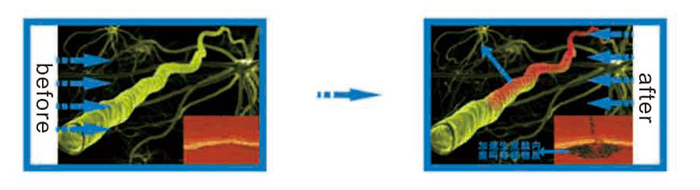 Multi-Functional Semiconductor Laser Therapy Instrument