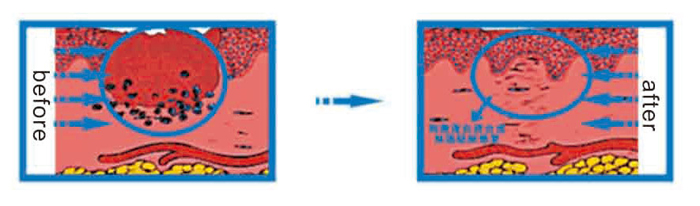 Multi-Functional Semiconductor Laser Therapy Instrument