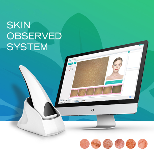 The Portable Skin Analyzer System