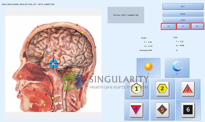 Biophilia Intruder Bioresonance Machine For Fast screening the Bacteria and Viruses