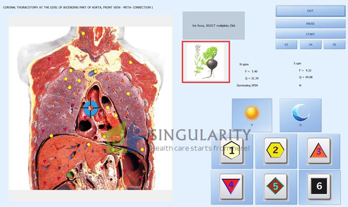 Biophilia Intruder Bioresonance Machine For Fast screening the Bacteria and Viruses