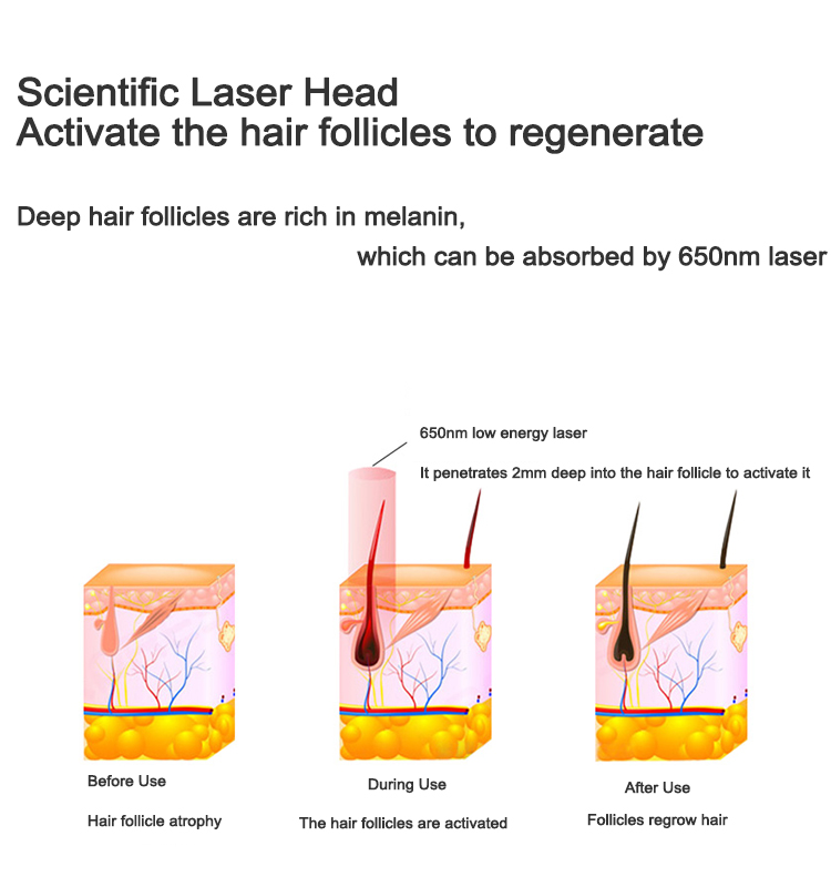 Laser Hair Growth Helmet Device Hair Loss Prevent Promote Hair Regrowth Cap